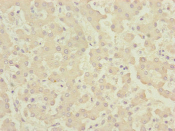 Immunohistochemistry of paraffin-embedded human liver tissue using CENPK Antibody at dilution of 1:100Rabbit anti-Human CENPK Polyclonal Antibody