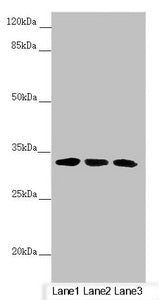 Western blot  | All lanes: CENPK antibody at 4.17µg/ml  | Lane 1: PC-3 whole cell lysate  | Lane 2: 293T whole cell lysate  | Lane 3: Hela whole cell lysate  | Secondary  | Goat polyclonal to rabbit IgG at 1/10000 dilution  | Predicted band size: 32 kDa  | Observed band size: 32 kDaRabbit anti-Human CENPK Polyclonal Antibody