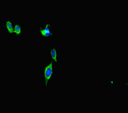 Immunofluorescent analysis of Hela cells using CEP290 Antibody at dilution of 1:100 and Alexa Fluor 488-congugated AffiniPure Goat Anti-Rabbit IgG(H+L)Rabbit anti-Human CEP290 Polyclonal Antibody