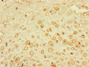 Immunohistochemistry of paraffin-embedded human placenta tissue using CEP290 Antibody at dilution of 1:100Rabbit anti-Human CEP290 Polyclonal Antibody