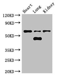 Western Blot | Positive WB detected in: Mouse heart tissue, Mouse lung tissue, Mouse kidney tissue | All lanes: CERK antibody at 3μg/ml | Secondary | Goat polyclonal to rabbit IgG at 1/50000 dilution | Predicted band size: 60, 38 kDa | Observed band size: 60, 48 kDa