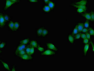Immunofluorescent analysis of HepG2 cells using CES1 Antibody at dilution of 1:100 and Alexa Fluor 488-congugated AffiniPure Goat Anti-Rabbit IgG(H+L)Rabbit anti-Human CES1 Polyclonal Antibody