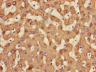 Immunohistochemistry of paraffin-embedded human liver tissue using CES1 Antibody at dilution of 1:100Rabbit anti-Human CES1 Polyclonal Antibody