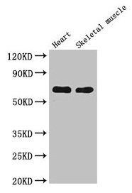 Western Blot  | Positive WB detected in: Mouse heart tissue, Mouse skeletal muscle tissue  | All lanes: CES1 antibody at 5µg/ml  | Secondary  | Goat polyclonal to rabbit IgG at 1/50000 dilution  | Predicted band size: 63 kDa  | Observed band size: 63 kDaRabbit anti-Human CES1 Polyclonal Antibody