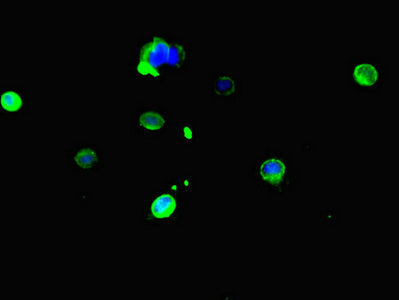 Immunofluorescent analysis of Hela cells using CES3 Antibody at dilution of 1:100 and Alexa Fluor 488-congugated AffiniPure Goat Anti-Rabbit IgG(H+L)Rabbit anti-Human CES3 Polyclonal Antibody