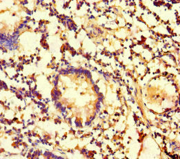 Immunohistochemistry of paraffin-embedded human appendix tissue using the antibody at dilution of 1:100Rabbit anti-Human CES3 Polyclonal Antibody