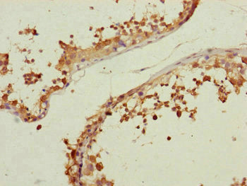 Immunohistochemistry of paraffin-embedded human testis tissue using CETN3 Antibody at dilution of 1:100Rabbit anti-Human CETN3 Polyclonal Antibody