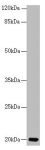 Western blot | All lanes: CETN3 antibody at 1.77 μg/ml + Mouse gonadal tissue | Secondary | Goat polyclonal to rabbit IgG at 1/10000 dilution | Predicted band size: 20 kDa | Observed band size: 20 kDaRabbit anti-Human CETN3 Polyclonal Antibody