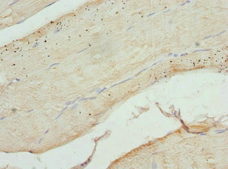 Immunohistochemistry of paraffin-embedded human skeletal muscle tissue using CFL2 Antibody at dilution of 1:100Rabbit anti-Human CFL2 Polyclonal Antibody