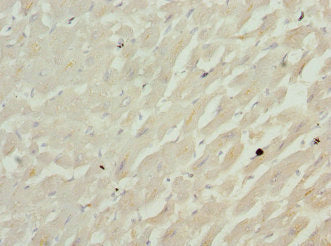 Immunohistochemistry of paraffin-embedded human heart tissue using CFL2 Antibody at dilution of 1:100Rabbit anti-Human CFL2 Polyclonal Antibody
