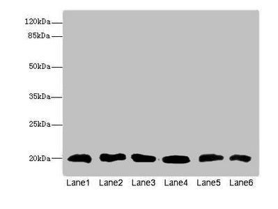 Western blot  | All lanes: CFL2 antibody at 3.75µg/ml  | Lane 1: Mouse brain tissue  | Lane 2: Mouse liver tissue  | Lane 3: Mouse lung tissue  | Lane 4: LO2 whole cell lysate  | Lane 5: Hela whole cell lysate  | Lane 6: A549 whole cell lysate  | Secondary  | Goat polyclonal to rabbit IgG at 1/10000 dilution  | Predicted band size: 19, 17 kDa  | Observed band size: 19 kDaRabbit anti-Human CFL2 Polyclonal Antibody