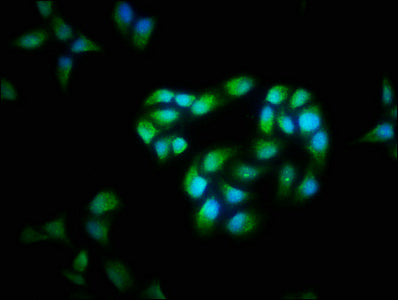 Immunofluorescence staining of Hela cells with the antibody at 1:40, counter-stained with DAPI. The cells were fixed in 4% formaldehyde, permeabilized using 0.2% Triton X-100 and blocked in 10% normal Goat Serum. The cells were then incubated with the antibody overnight at 4°C. The secondary antibody was Alexa Fluor 488-congugated AffiniPure Goat Anti-Rabbit IgG(H+L).Rabbit anti-Human CFLAR Polyclonal Antibody