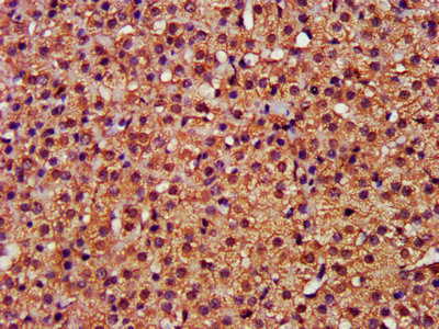 IHC image of CFLAR Antibody diluted at 1:400 and staining in paraffin-embedded human adrenal gland tissue performed on a Leica BondTM system. After dewaxing and hydration, antigen retrieval was mediated by high pressure in a citrate buffer (pH 6.0). Section was blocked with 10% normal goat serum 30min at RT. Then primary antibody (1% BSA) was incubated at 4°C overnight. The primary is detected by a biotinylated secondary antibody and visualized using an HRP conjugated SP system.Rabbit anti-Human CFLAR Polyclonal Antibody