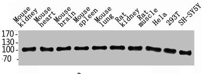 Western Blot analysis of rat-kidney hela 293T SH-SY5Y MOUSE-KIDNEY MOUSE-SPLEEN MOUSE-LUNG using ENPP3 Polyclonal Antibody.Rabbit anti-Human ENPP3 Polyclonal Antibody