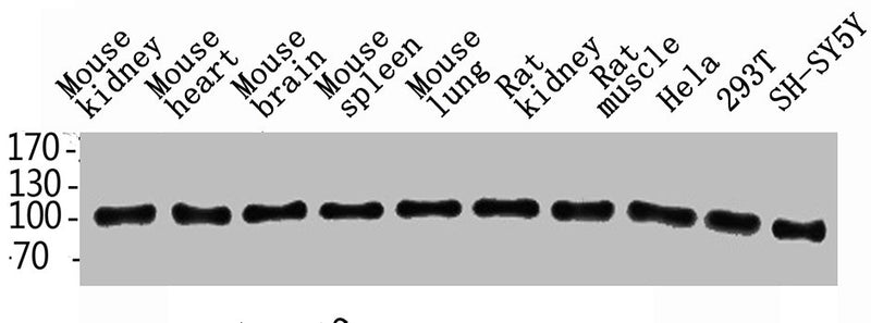 Western Blot analysis of rat-kidney hela 293T SH-SY5Y MOUSE-KIDNEY MOUSE-SPLEEN MOUSE-LUNG using ENPP3 Polyclonal Antibody.Rabbit anti-Human ENPP3 Polyclonal Antibody