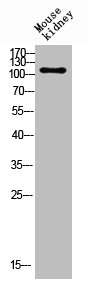 Western blot analysis of mouse-kidney lysis using CD203c antibody.Rabbit anti-Human ENPP3 Polyclonal Antibody