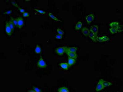 Immunofluorescent analysis of HepG2 cells using CHAT Antibody at dilution of 1:100 and Alexa Fluor 488-congugated AffiniPure Goat Anti-Rabbit IgG(H+L)Rabbit anti-Human CHAT Polyclonal Antibody