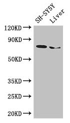 Western BlotPositive WB detected in: SH-SY5Y whole cell lysate, Mouse liver tissueAll lanes: CHAT antibody at 3µg/mlSecondaryGoat polyclonal to rabbit IgG at 1/50000 dilutionPredicted band size: 83, 75, 71 kDaObserved band size: 75 kDaRabbit anti-Human CHAT Polyclonal Antibody