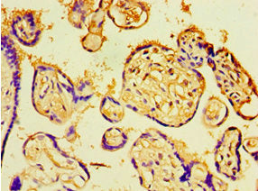 Immunohistochemistry of paraffin-embedded human placenta tissue using CHD1 Antibody at dilution of 1:100Rabbit anti-Human CHD1 Polyclonal Antibody