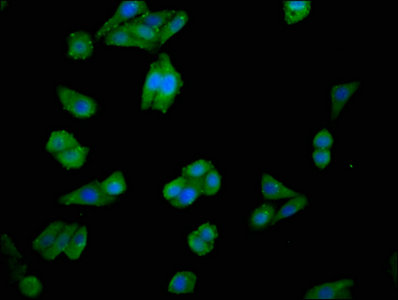 Immunofluorescence staining of HepG2 cells with CHKA Antibody at 1:100, counter-stained with DAPI. The cells were fixed in 4% formaldehyde, permeabilized using 0.2% Triton X-100 and blocked in 10% normal Goat Serum. The cells were then incubated with the antibody overnight at 4°C. The secondary antibody was Alexa Fluor 488-congugated AffiniPure Goat Anti-Rabbit IgG(H+L).Rabbit anti-Human CHKA Polyclonal Antibody