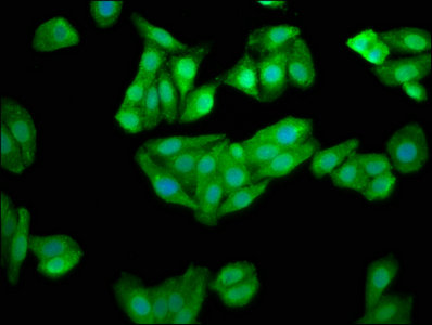 Immunofluorescence staining of HepG2 cells with CHKB Antibody at 1:100, counter-stained with DAPI. The cells were fixed in 4% formaldehyde, permeabilized using 0.2% Triton X-100 and blocked in 10% normal Goat Serum. The cells were then incubated with the antibody overnight at 4°C. The secondary antibody was Alexa Fluor 488-congugated AffiniPure Goat Anti-Rabbit IgG(H+L).Rabbit anti-Human CHKB Polyclonal Antibody