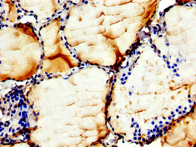 IHC image of CHKB Antibody diluted at 1:300 and staining in paraffin-embedded human thyroid tissue performed on a Leica BondTM system. After dewaxing and hydration, antigen retrieval was mediated by high pressure in a citrate buffer (pH 6.0). Section was blocked with 10% normal goat serum 30min at RT. Then primary antibody (1% BSA) was incubated at 4°C overnight. The primary is detected by a biotinylated secondary antibody and visualized using an HRP conjugated SP system.Rabbit anti-Human CHKB Polyclonal Antibody