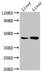 Western Blot | Positive WB detected in: Rat liver tissue, Mouse liver tissue | All lanes: CHKB antibody at 6.6μg/ml | Secondary | Goat polyclonal to rabbit IgG at 1/50000 dilution | Predicted band size: 46, 14 kDa | Observed band size: 46 kDaRabbit anti-Human CHKB Polyclonal Antibody