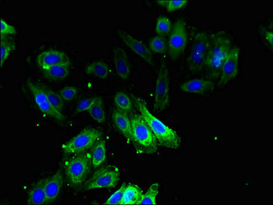 Immunofluorescent analysis of HepG2 cells using ODC1 Antibody at dilution of 1:100 and Alexa Fluor 488-congugated AffiniPure Goat Anti-Rabbit IgG(H+L)Rabbit anti-Human ODC1 Polyclonal Antibody