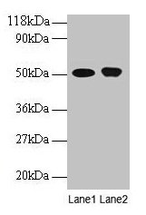 Western blot  | All lanes: ODC1 antibody at 2µg/ml  | Lane 1: EC109 whole cell lysate  | Lane 2: 293T whole cell lysate  | Secondary  | Goat polyclonal to rabbit IgG at 1/15000 dilution  | Predicted band size: 52 kDa  | Observed band size: 52 kDaRabbit anti-Human ODC1 Polyclonal Antibody
