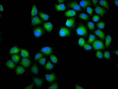 Immunofluorescence staining of Hela cells with CHODL Antibody at 1:100, counter-stained with DAPI. The cells were fixed in 4% formaldehyde, permeabilized using 0.2% Triton X-100 and blocked in 10% normal Goat Serum. The cells were then incubated with the antibody overnight at 4°C. The secondary antibody was Alexa Fluor 488-congugated AffiniPure Goat Anti-Rabbit IgG(H+L).Rabbit anti-Human CHODL Polyclonal Antibody