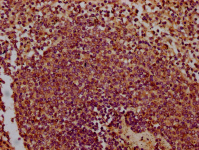 IHC image of CHODL Antibody diluted at 1:300 and staining in paraffin-embedded human spleen tissue performed on a Leica BondTM system. After dewaxing and hydration, antigen retrieval was mediated by high pressure in a citrate buffer (pH 6.0). Section was blocked with 10% normal goat serum 30min at RT. Then primary antibody (1% BSA) was incubated at 4°C overnight. The primary is detected by a biotinylated secondary antibody and visualized using an HRP conjugated SP system.Rabbit anti-Human CHODL Polyclonal Antibody