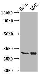 Western Blot  | Positive WB detected in: Hela whole cell lysate, K562 whole cell lysate  | All lanes: CHODL antibody at 6.2µg/ml  | Secondary  | Goat polyclonal to rabbit IgG at 1/50000 dilution  | Predicted band size: 31, 26, 28, 29 kDa  | Observed band size: 31 kDaRabbit anti-Human CHODL Polyclonal Antibody