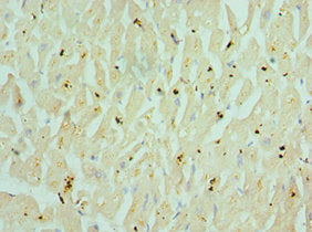Immunohistochemistry of paraffin-embedded human heart tissue using CHRM3 Antibody at dilution of 1:100Rabbit anti-Human CHRM3 Polyclonal Antibody