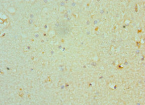 Immunohistochemistry of paraffin-embedded human brain tissue using CHRM3 Antibody at dilution of 1:100Rabbit anti-Human CHRM3 Polyclonal Antibody