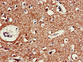 Immunohistochemistry of paraffin-embedded human brain tissue using CHRM5 Antibody at dilution of 1:100Rabbit anti-Human CHRM5 Polyclonal Antibody