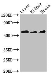 Western Blot | Positive WB detected in: Mouse liver tissue, Mouse kidney tissue, Mouse brain tissue | All lanes: CHRM5 antibody at 3.5μg/ml | Secondary | Goat polyclonal to rabbit IgG at 1/50000 dilution | Predicted band size: 61 kDa | Observed band size: 61 kDaRabbit anti-Human CHRM5 Polyclonal Antibody