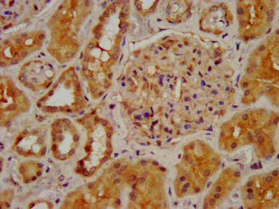 IHC image of CHRNB2 Antibody diluted at 1:400 and staining in paraffin-embedded human kidney tissue performed on a Leica BondTM system. After dewaxing and hydration, antigen retrieval was mediated by high pressure in a citrate buffer (pH 6.0). Section was blocked with 10% normal goat serum 30min at RT. Then primary antibody (1% BSA) was incubated at 4°C overnight. The primary is detected by a biotinylated secondary antibody and visualized using an HRP conjugated SP system.Rabbit anti-Human CHRNB2 Polyclonal Antibody