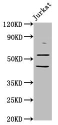 Western Blot | Positive WB detected in: Jurkat whole cell lysate | All lanes: CHRNB2 antibody at 6.05μg/ml | Secondary | Goat polyclonal to rabbit IgG at 1/50000 dilution | Predicted band size: 58 kDa | Observed band size: 58 kDaRabbit anti-Human CHRNB2 Polyclonal Antibody