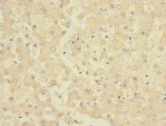 Immunohistochemistry of paraffin-embedded human liver tissue using CHRNE Antibody at dilution of 1:100Rabbit anti-Human CHRNE Polyclonal Antibody