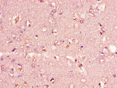 Immunohistochemistry of paraffin-embedded human brain tissue using CIDEA Antibody at dilution of 1:100Rabbit anti-Human CIDEA Polyclonal Antibody