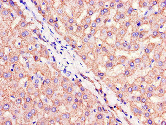 Immunohistochemistry of paraffin-embedded human liver tissue using CIDEA Antibody at dilution of 1:100Rabbit anti-Human CIDEA Polyclonal Antibody