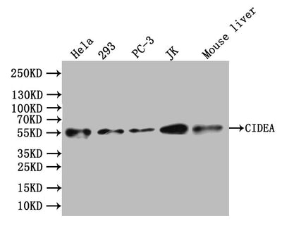 Western Blot | Positive WB detected in: Mouse liver tissue | All lanes: CIDEA antibody at 3.4μg/ml | Secondary | Goat polyclonal to rabbit IgG at 1/50000 dilution | Predicted band size: 25 kDa | Observed band size: 25 kDaRabbit anti-Human CIDEA Polyclonal Antibody