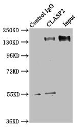 Immunoprecipitating CLASP2 in HEK293 whole cell lysate  | Lane 1: Rabbit control IgG instead of CLASP2 Antibody in HEK293 whole cell lysate. For western blotting, a HRP-conjugated Protein G antibody was used as the secondary antibody (1/2000)  | Lane 2: CLASP2 Antibody (8µg) + HEK293 whole cell lysate (500µg)  | Lane 3: HEK293 whole cell lysate (10µg)Rabbit anti-Human CLASP2 Polyclonal Antibody
