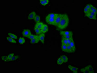 Immunofluorescence staining of HepG2 cells with CLCNKB Antibody at 1:100, counter-stained with DAPI. The cells were fixed in 4% formaldehyde, permeabilized using 0.2% Triton X-100 and blocked in 10% normal Goat Serum. The cells were then incubated with the antibody overnight at 4°C. The secondary antibody was Alexa Fluor 488-congugated AffiniPure Goat Anti-Rabbit IgG(H+L).Rabbit anti-Human CLCNKB Polyclonal Antibody