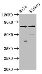 Western Blot  | Positive WB detected in: Hela whole cell lysate, Rat kidney tissue  | All lanes: CLCNKB antibody at 3µg/ml  | Secondary  | Goat polyclonal to rabbit IgG at 1/50000 dilution  | Predicted band size: 76, 57 kDa  | Observed band size: 76 kDaRabbit anti-Human CLCNKB Polyclonal Antibody