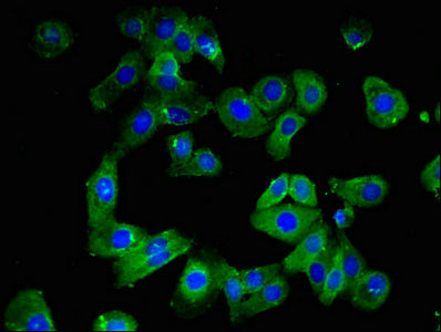 Immunofluorescent analysis of HepG2 cells using CLDN10 Antibody at dilution of 1:100 and Alexa Fluor 488-congugated AffiniPure Goat Anti-Rabbit IgG(H+L)Rabbit anti-Human CLDN10 Polyclonal Antibody