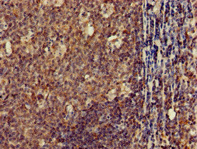 Immunohistochemistry of paraffin-embedded human tonsil tissue using CLDN10 Antibody at dilution of 1:100Rabbit anti-Human CLDN10 Polyclonal Antibody