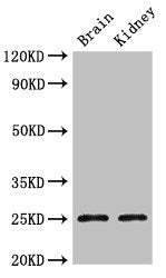 Western Blot | Positive WB detected in: Mouse brain tissue, Mouse kidney tissue | All lanes: CLDN10 antibody at 2.4μg/ml | Secondary | Goat polyclonal to rabbit IgG at 1/50000 dilution | Predicted band size: 25, 23 kDa | Observed band size: 25 kDaRabbit anti-Human CLDN10 Polyclonal Antibody