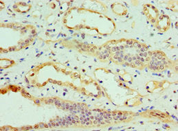 Immunohistochemistry of paraffin-embedded human kidney tissue using CLDN14 Antibody at dilution of 1:100