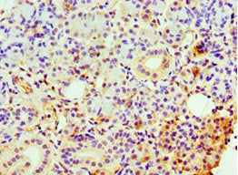 Immunohistochemistry of paraffin-embedded human pancreatic tissue using CLDN14 Antibody at dilution of 1:100